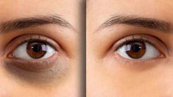 Is Apple Vision Pro hurting your eyes How many hours should it take