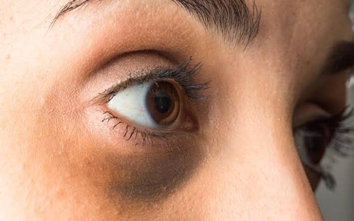 Is Apple Vision Pro hurting your eyes How many hours should it take