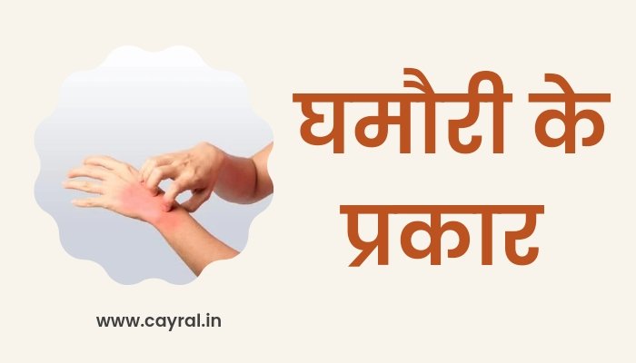 Ghamori kaise theek karen