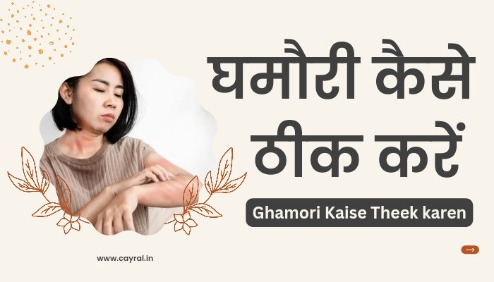 Ghamori kaise theek karen: घमौरी कैसे ठीक करें, ठंडी जगह पर रहें, पहनें ढीले और सूती कपड़े
