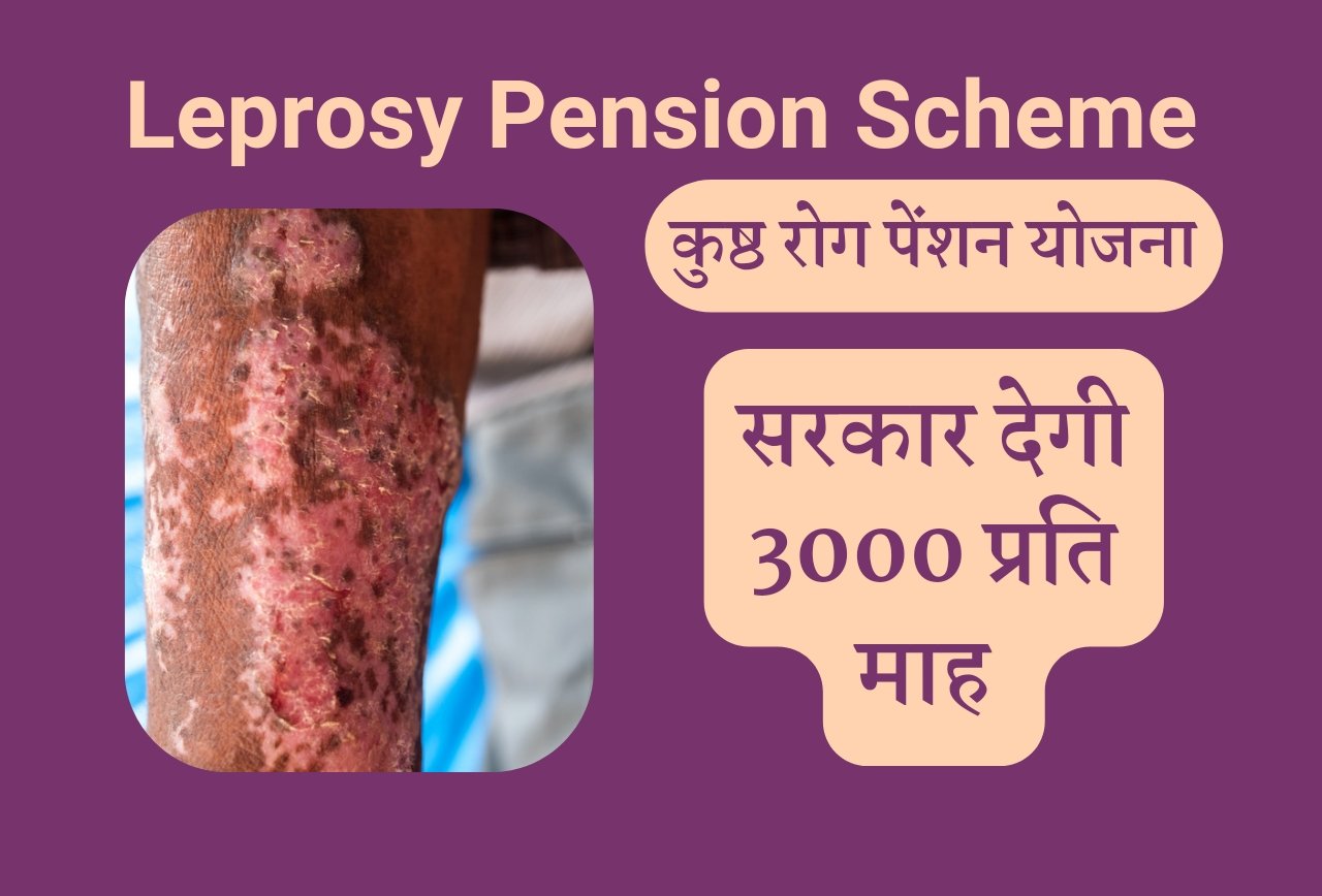 Leprosy Pension Scheme कुष्ठ रोग पेंशन योजना में कुष्ठ रोगियों को 3000 रुपये प्रति माह मिलेंगे, जानें कैसे