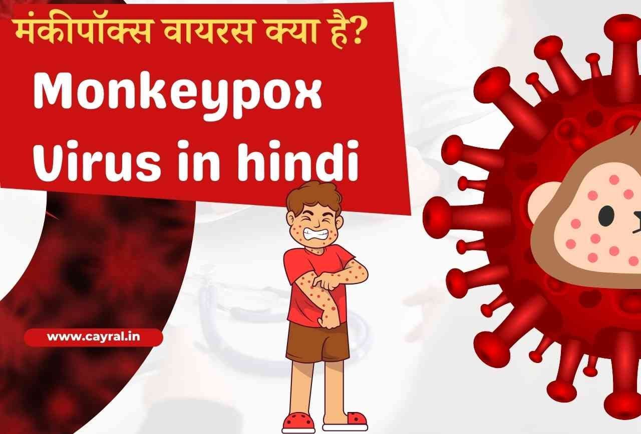 Monkeypox Virus in hindi: मंकीपॉक्स वायरस क्या है? What is Monkeypox Virus?
