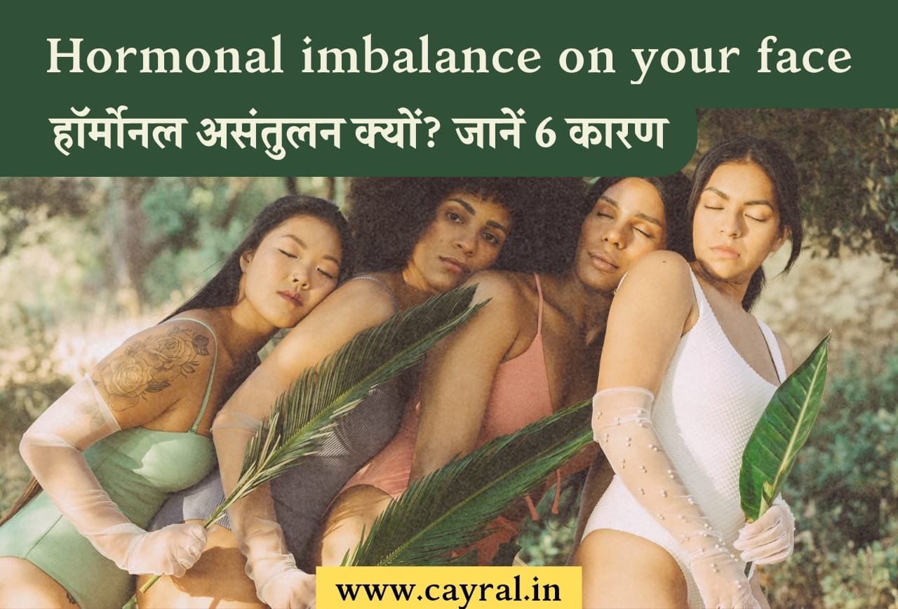 Hormonal imbalance on your face: चेहरे पर क्यों निकलते हैं पीपल्स? जानें हार्मोनल असंतुलन के 6 संकेत